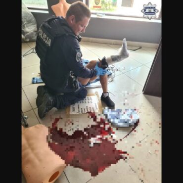 Policjanci udzielili pierwszej pomocy 51-latce, która doznała poważnego urazu podczas przenoszenia wyposażenia sklepu w Świętochłowicach. Kobieta rozbiła duże lustro, a odłamki szkła rozcięły skórę powodując głęboką ranę nogi i silne krwawienie.