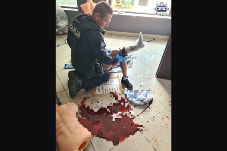 Policjanci udzielili pierwszej pomocy 51-latce, która doznała poważnego urazu podczas przenoszenia wyposażenia sklepu w Świętochłowicach. Kobieta rozbiła duże lustro, a odłamki szkła rozcięły skórę powodując głęboką ranę nogi i silne krwawienie.