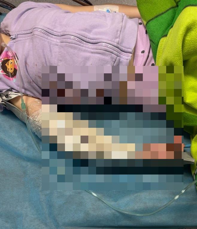 Katowice: groźny wypadek na tyrolce. Lekarze z GCZD w Katowicach uratowali rękę dziecka. Fot. GCZD